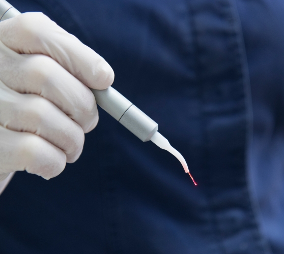 Dentist holding a pen like dental laser device