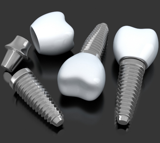 Three dental implants and three dental crowns resting on table